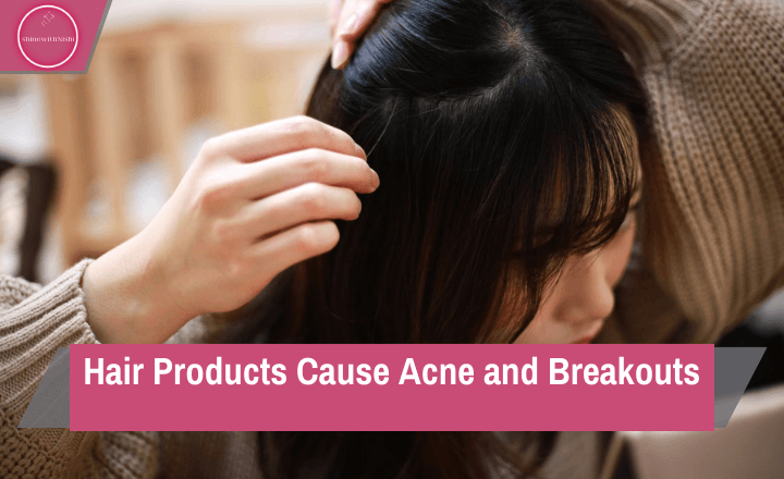 Hair Products Cause Acne